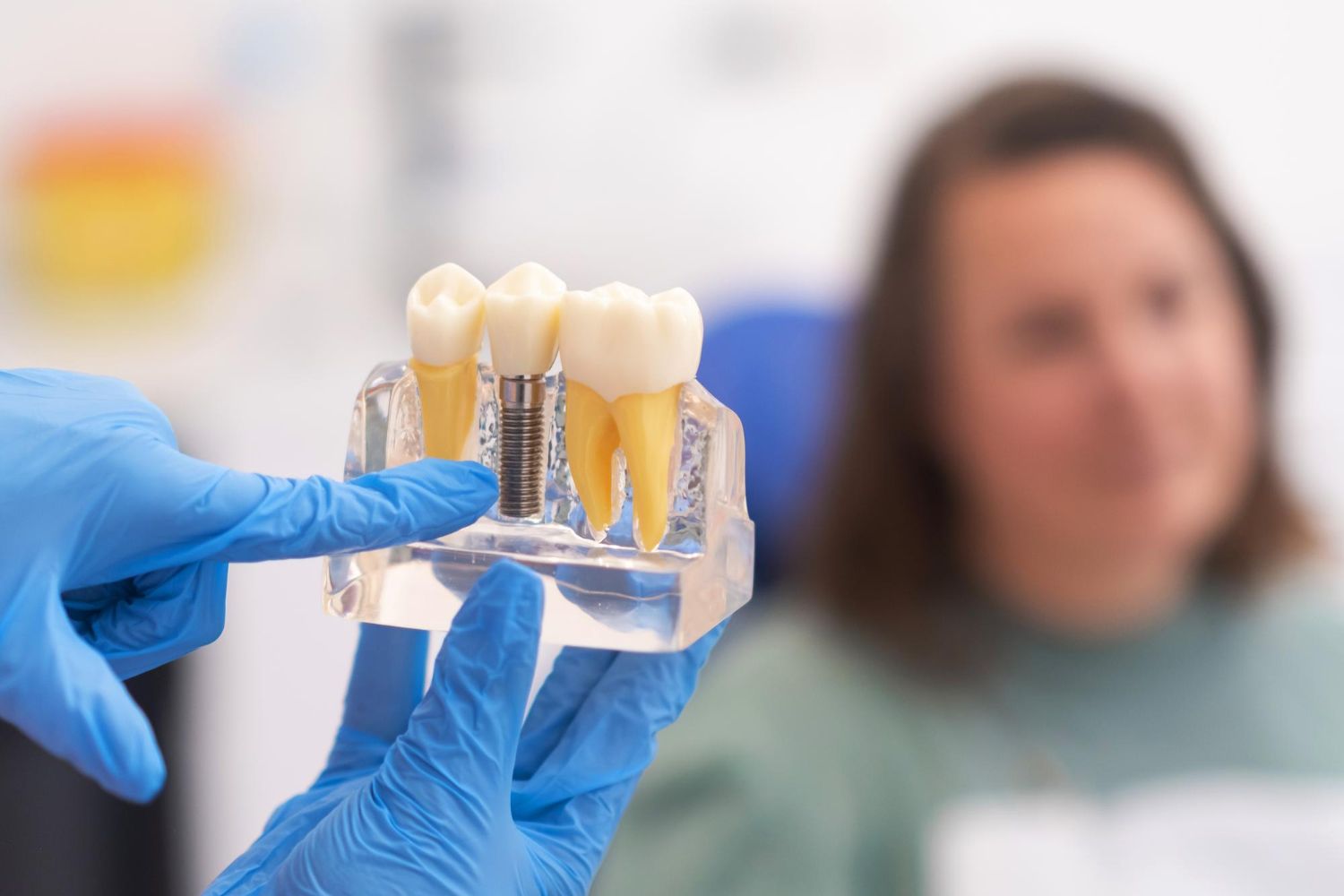 Revive Dental | Dental Implants vs. Dentures: Which is Right for You?
