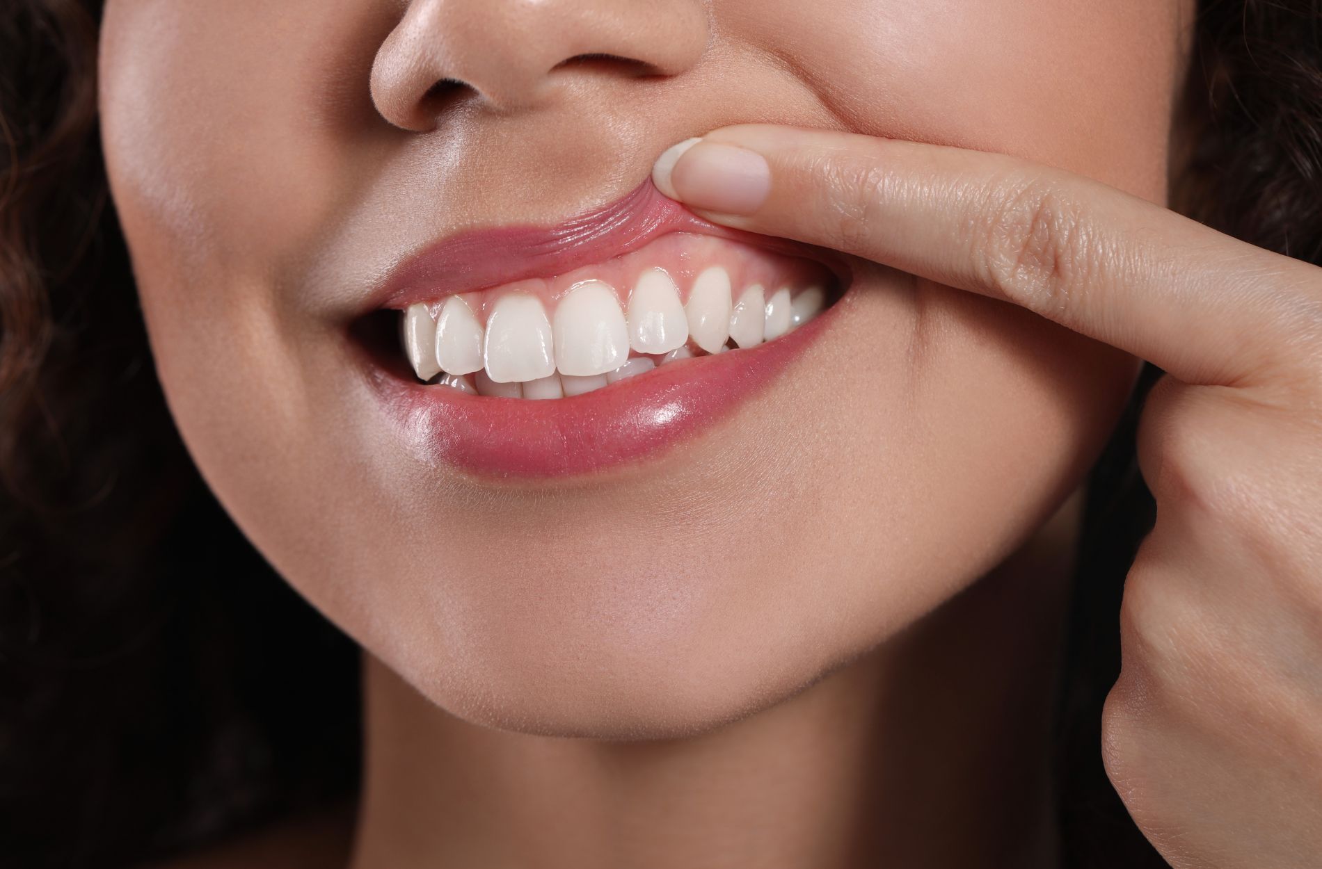 Revive Dental | Keeping Teeth and Gums Healthy: What You Should Eat