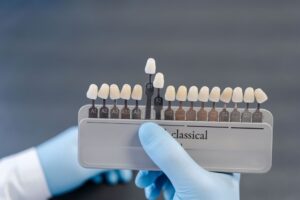 Revive Dental | Front-Facing Fix or Full Restoration? Understanding Veneers vs. Crowns Revive Dental | Front-Facing Fix or Full Restoration? Understanding Veneers vs. Crowns