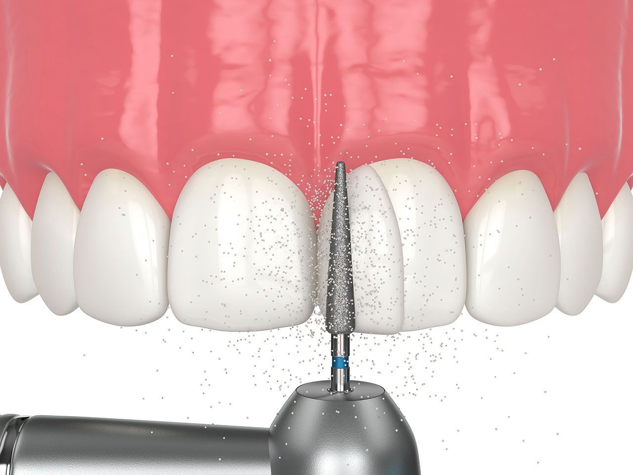 Revive Dental | Restorative Dentistry