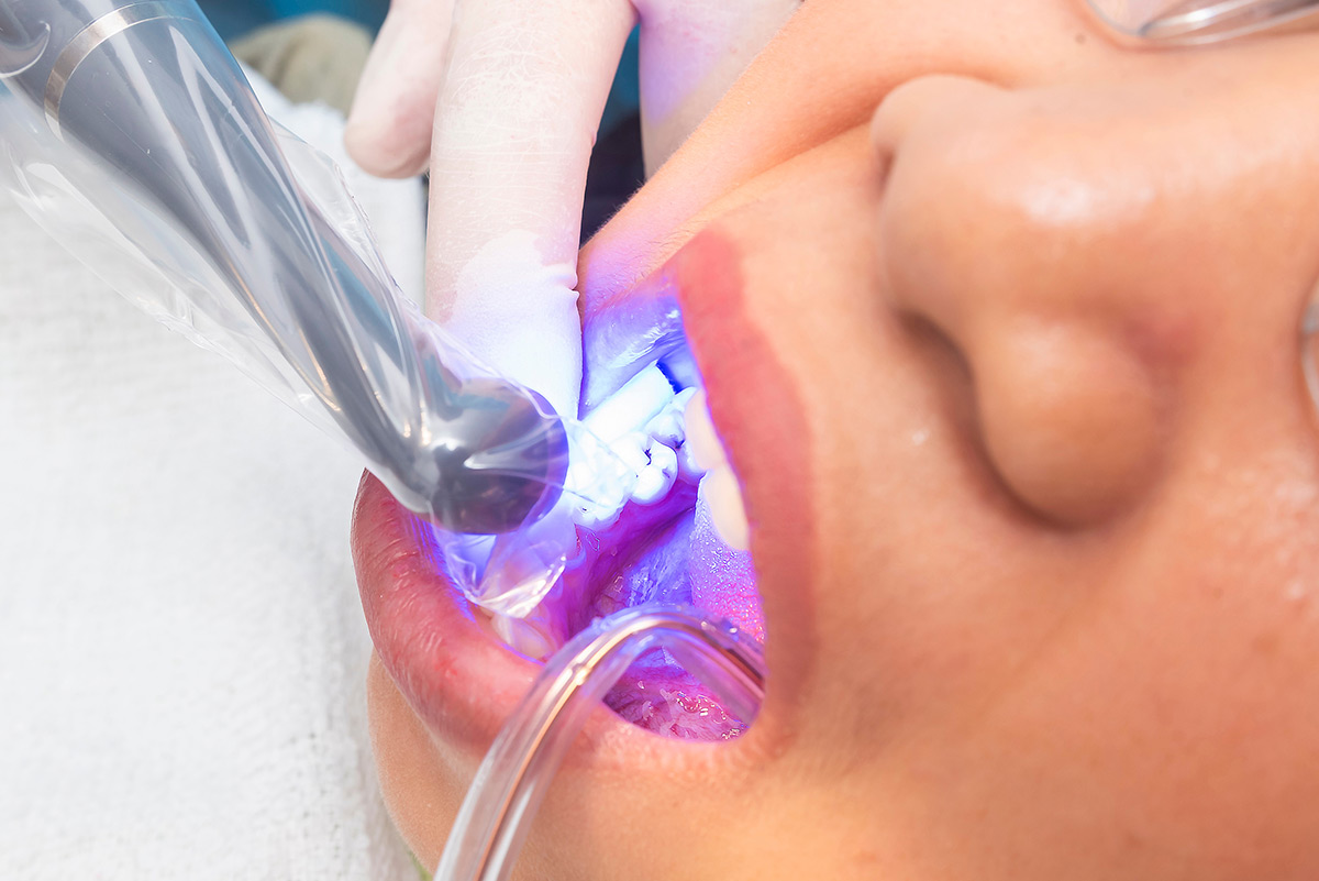 Revive Dental | Preventive Dentistry