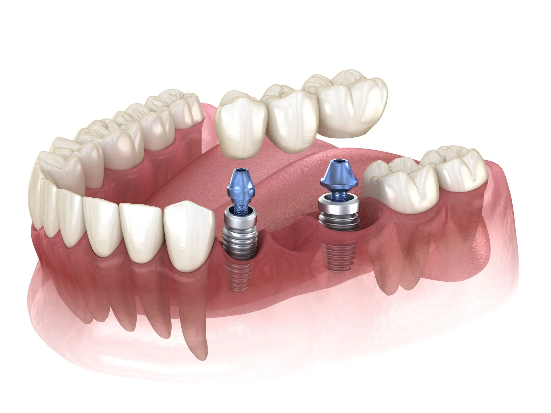 Revive Dental | Restorative Dentistry