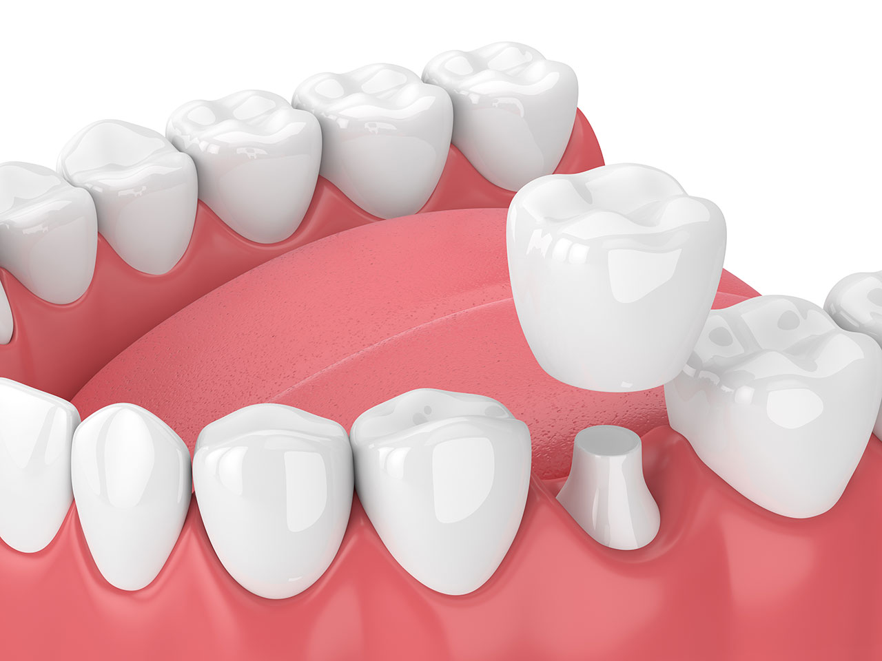 Revive Dental | Restorative Dentistry