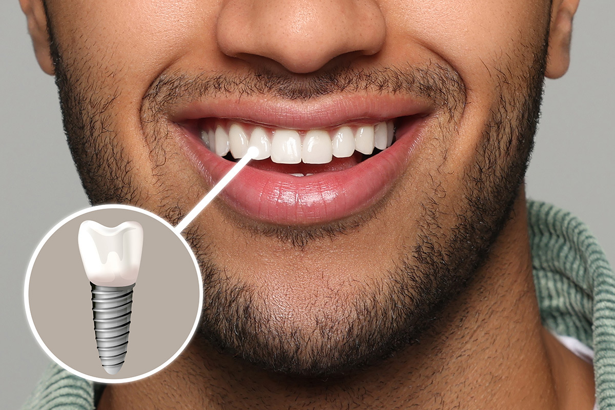 Revive Dental | Home